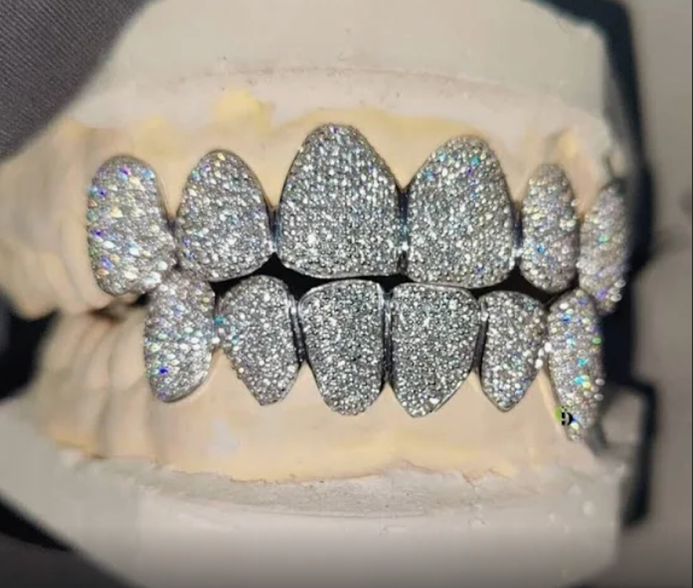 MOISSANITE GRILLZ