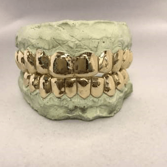 14K GOLD GRILLZ