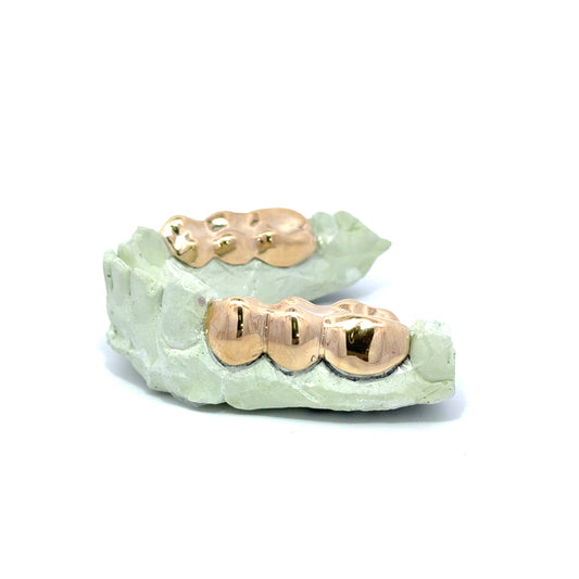 3 PIECE GOLD GRILLZ