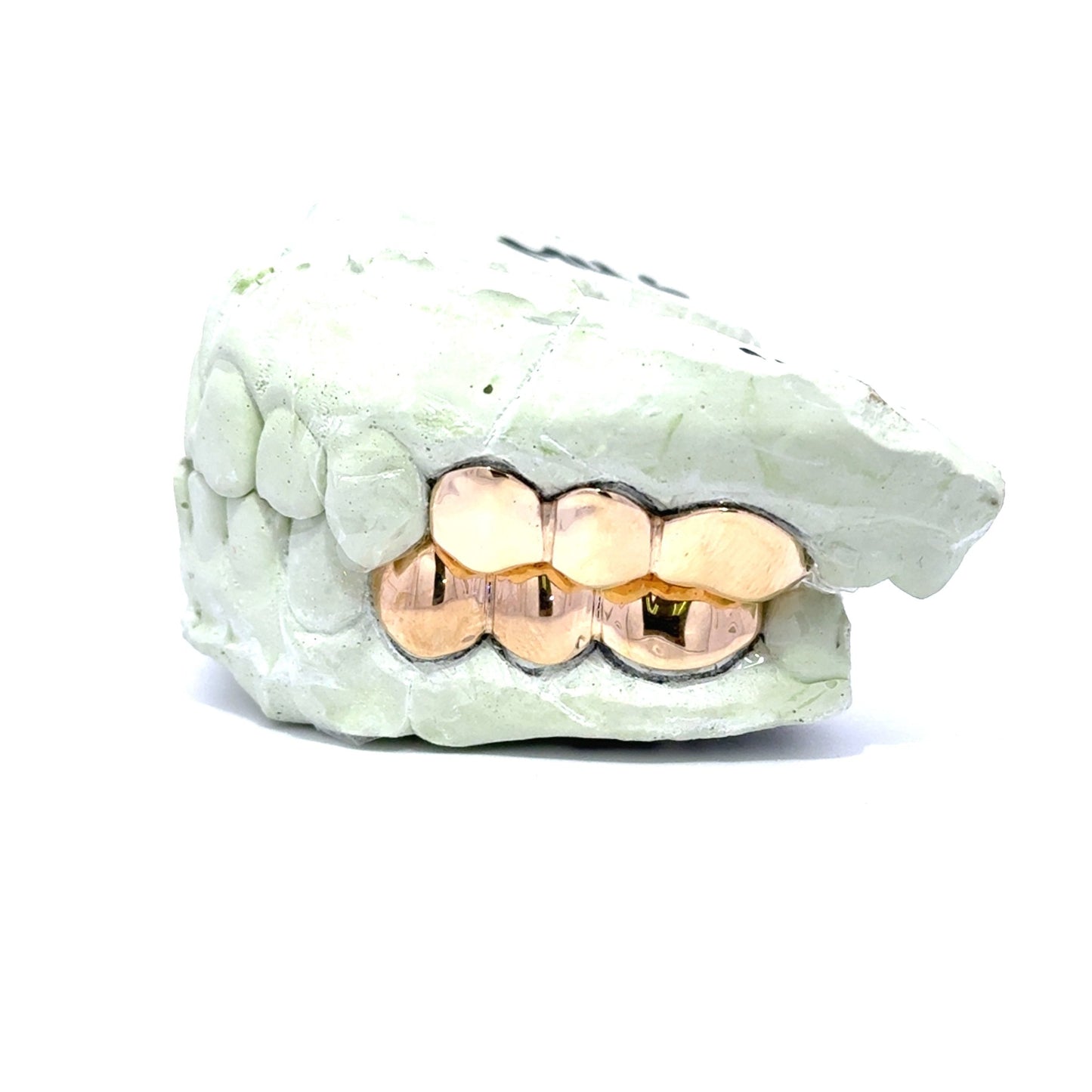 3 PIECE GOLD GRILLZ